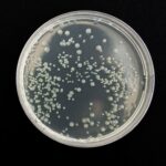Yourqa microbiologie